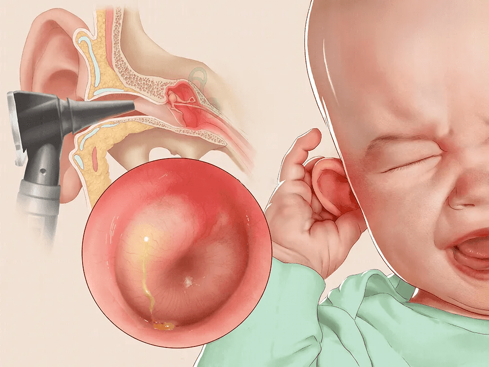 耳炎，全面解析、预防与治疗方法