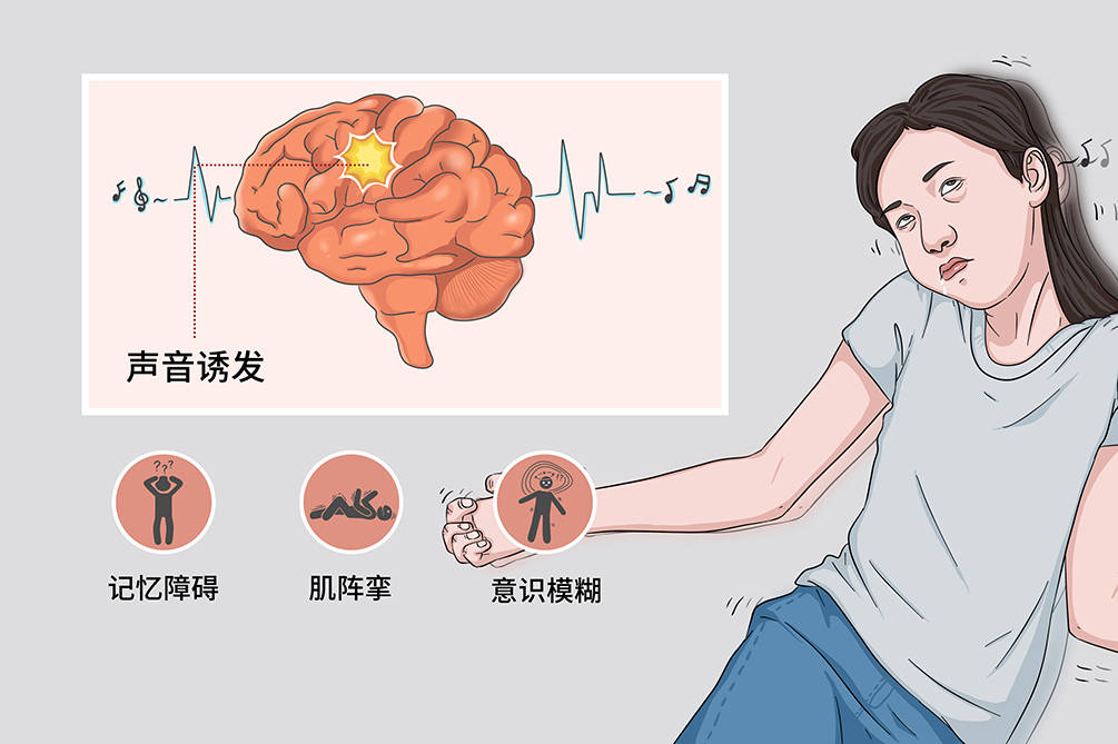 痉挛性发声障碍，深度解析与探讨